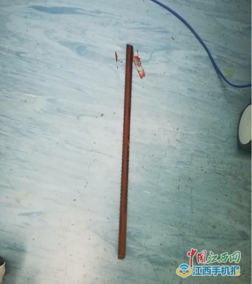 抚州市第一人民医院:多科配合成功抢救一下颌被钢筋刺穿男子的生命 抚州市第一人民医院:多科配合成功抢救一下颌被钢筋刺穿男子的生命