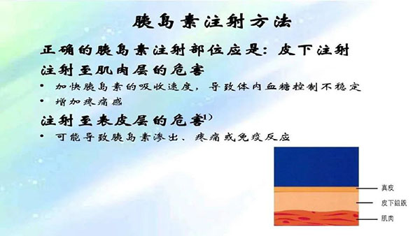 教你如何规范、合理的用药