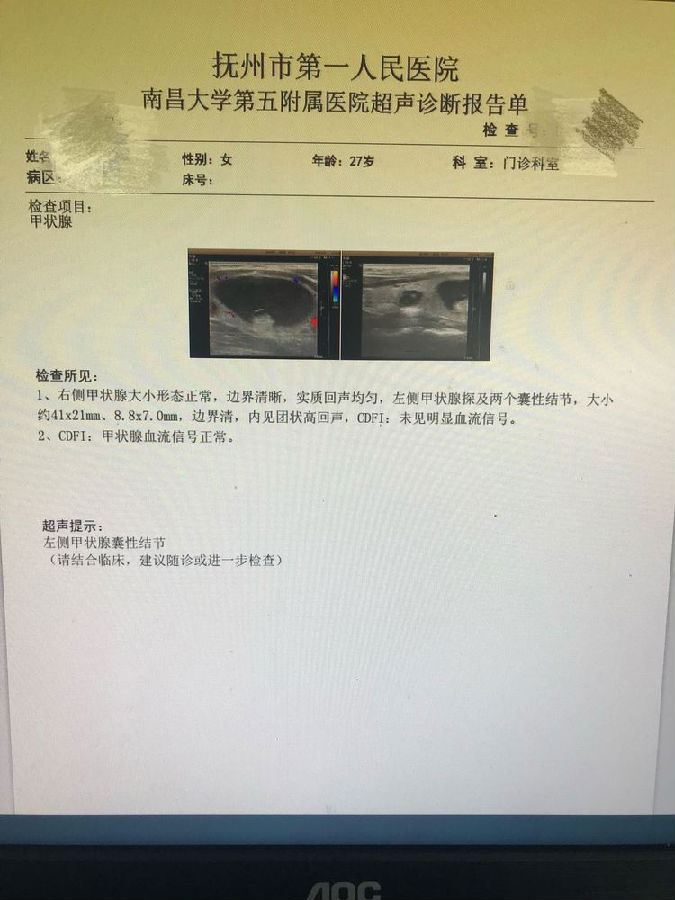 全腔镜下甲状腺腺叶切除术